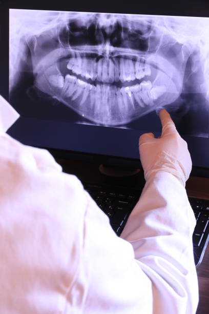 Best Emergency Root Canal Treatment in Navajo, NM